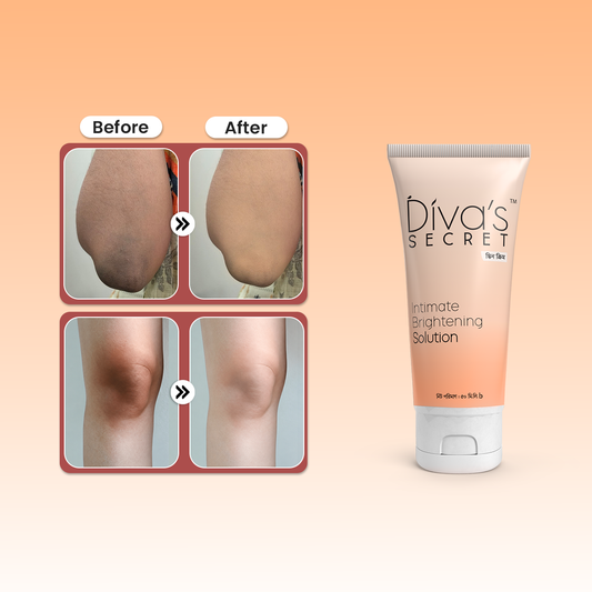 Sun Tan and Body Pigmentation Removal Solution for Uneven Skin Tone
