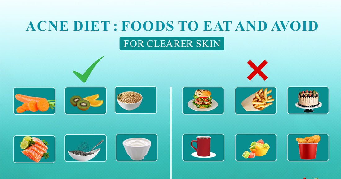 Acne Diet : Foods to Eat and Avoid for Clearer Skin