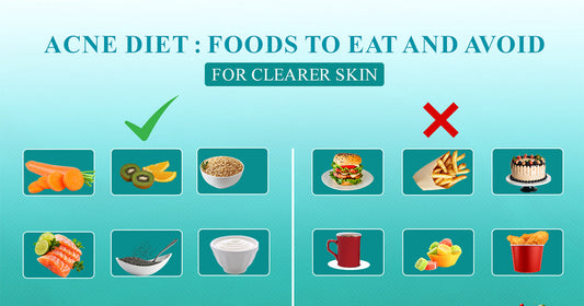 Acne Diet : Foods to Eat and Avoid for Clearer Skin