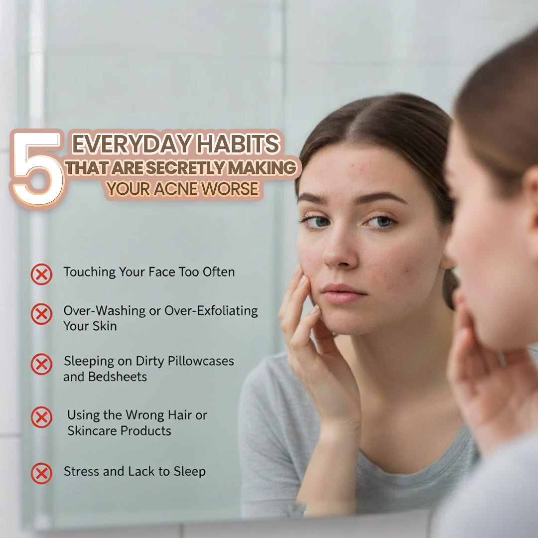 5 Everyday Habits That Are Secretly Making Your Acne Worse