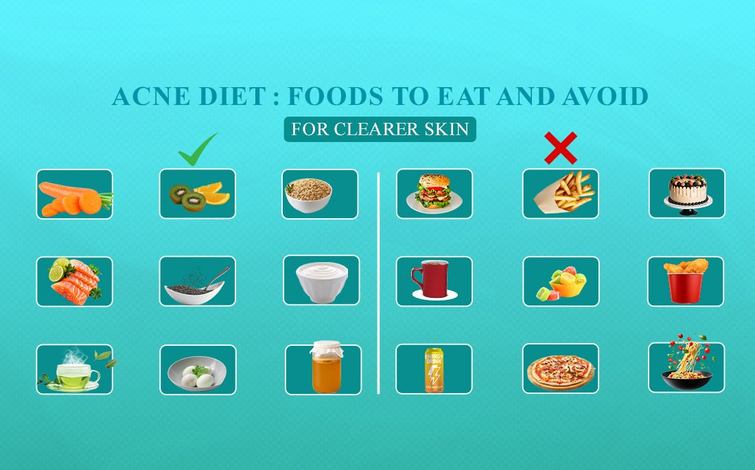 Acne Diet : Foods to Eat and Avoid for Clearer Skin