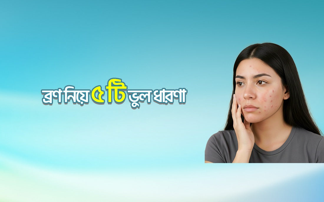ব্রণ নিয়ে  ৫টি ভুল ধারণা