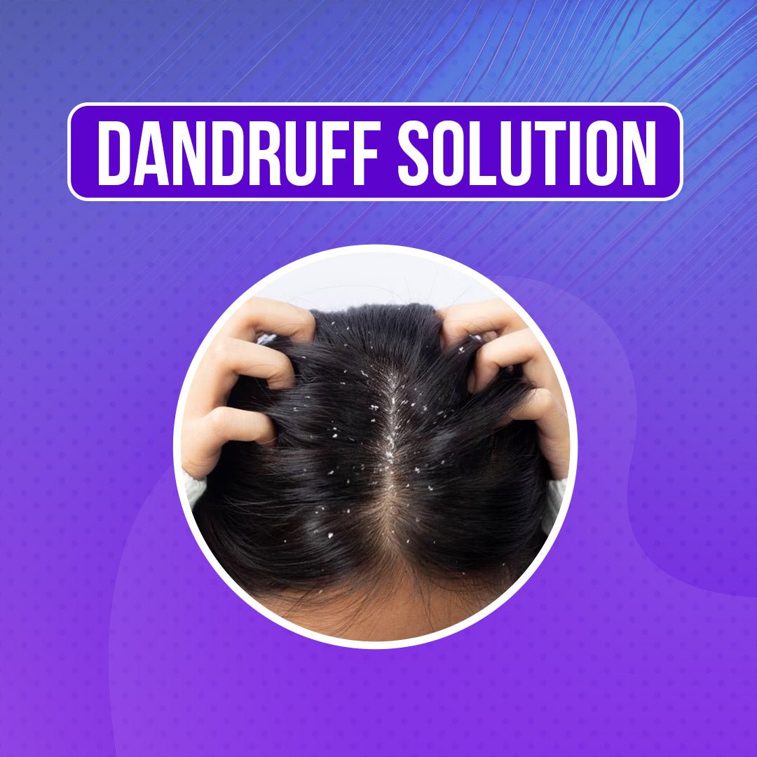 Dandruff Solution