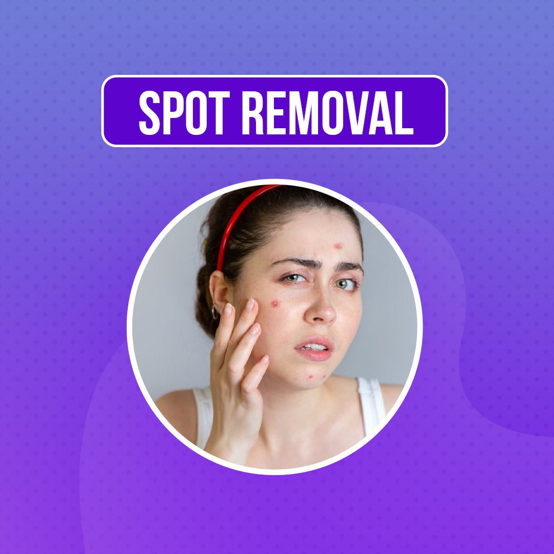 Spot Removal