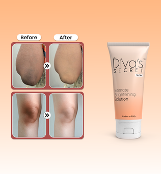  Sun Tan and Body Pigmentation Removal Solution for Uneven Skin Tone